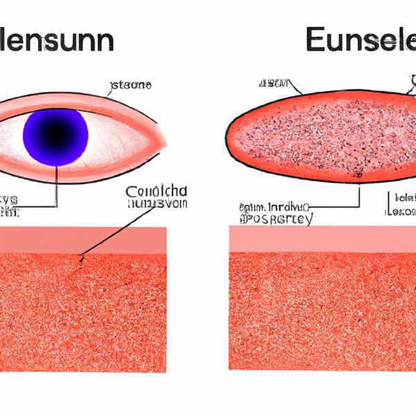 Отличие эпителия роговицы глаза и эпидермиса кожи