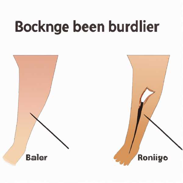 Ушиб или перелом пальца на ноге отличия