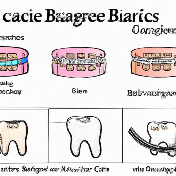 Виды брекетов и их стоимость и отличия